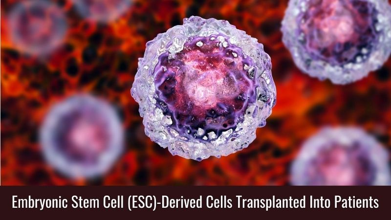 Embryonic Stem Cell (ESC)-Derived Cells Transplanted Into Patients